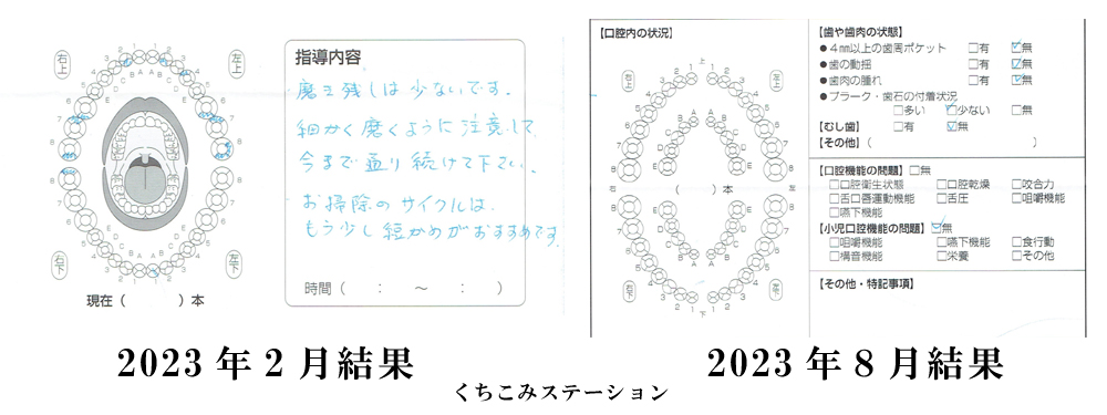 supikaを使った歯科検診の結果